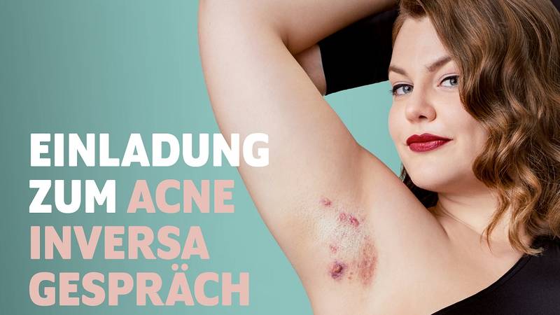 Acne inversa Gespräch: Eine Informationsveranstaltung zur systemischen Hauterkrankung