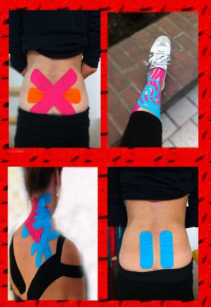 Kinesio Tape - eine kostenfreie Behandlung! 
